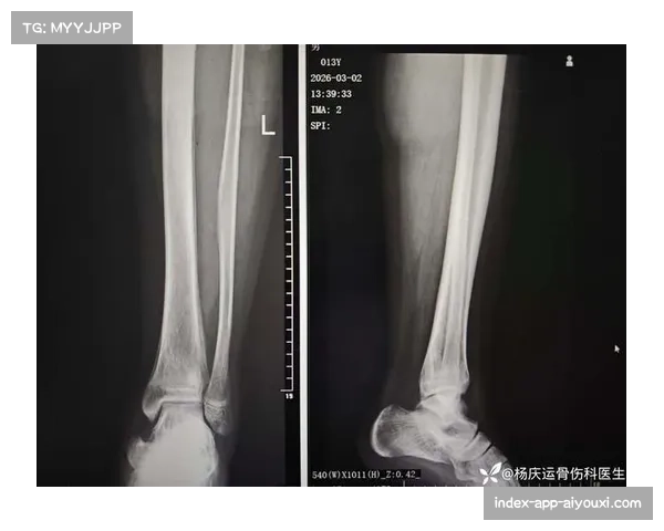 朱旭航胫骨骨折康复超一年 新疆高价签约难获回报